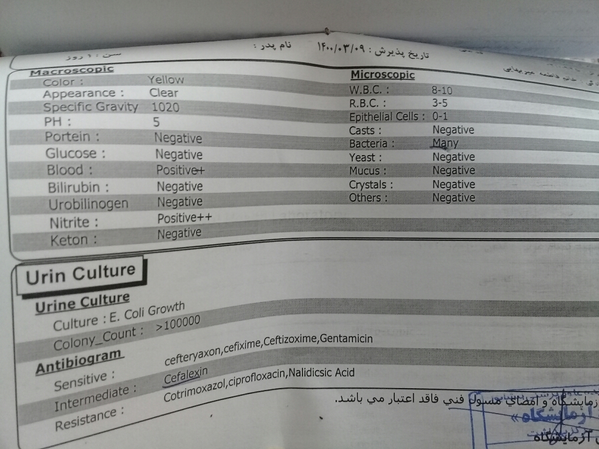 سلام خانومای عزیز این آزمایش و نگا میکنین