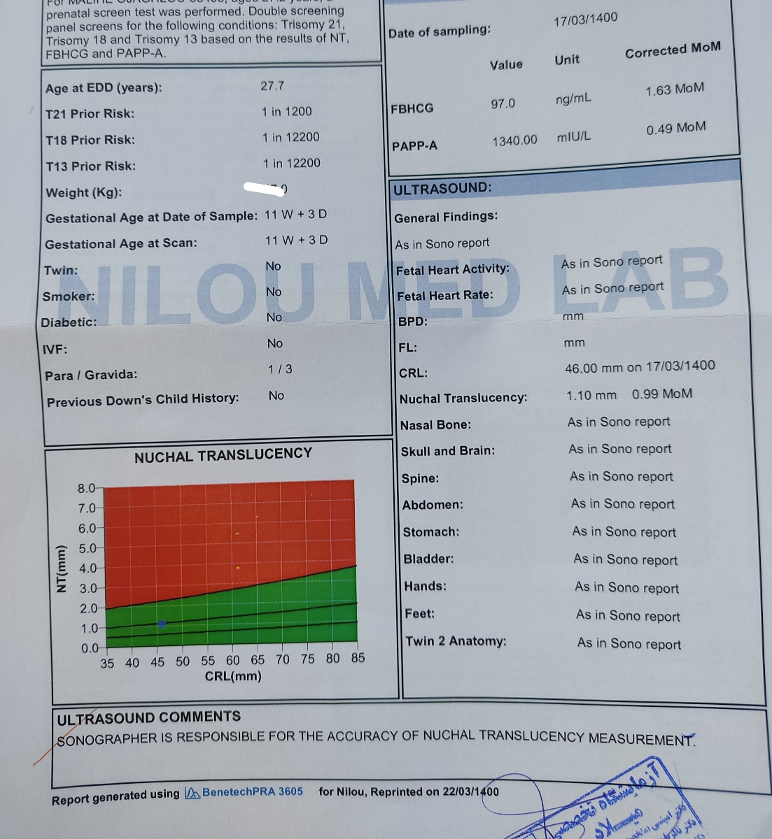 تفسیر آزمایش غربالگری اول