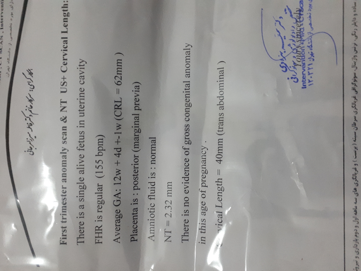 تعیین جنسیت جنین