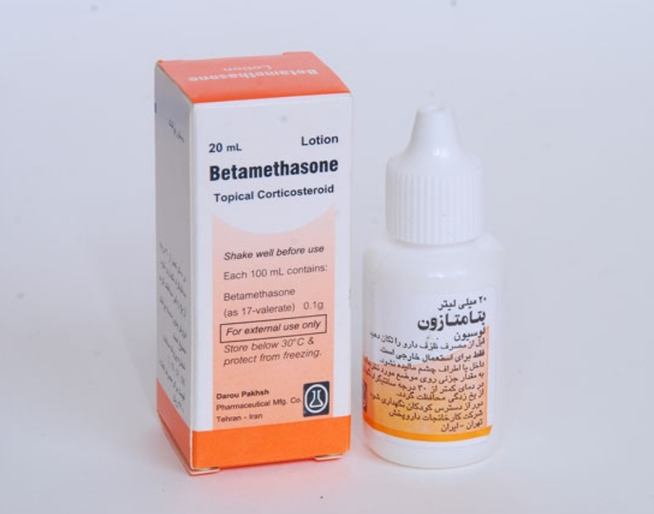 اگزما نوزاد ۱۰ ماهه