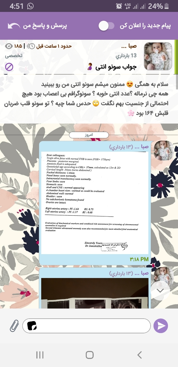 تعیین جنسیت از روی سونو ان تی تعیین جنسیت از روی سونو ان تی