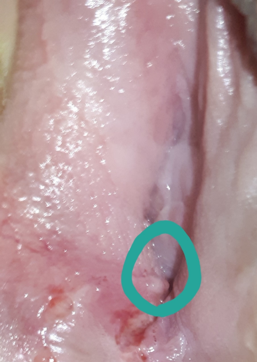 وجود یک زائده ی سفید رنگ +ببخشید بابت تصویر وجود یک زائده ی سفید رنگ +ببخشید بابت تصویر