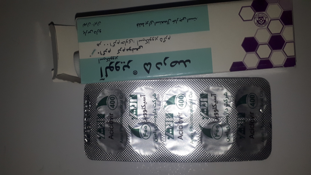 وجود یک زائده ی سفید رنگ +ببخشید بابت تصویر وجود یک زائده ی سفید رنگ +ببخشید بابت تصویر
