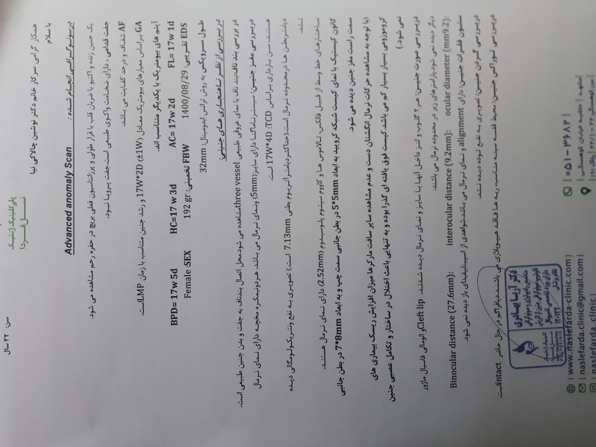 کیست ناحیه خلفی مغز کیست ناحیه خلفی مغز