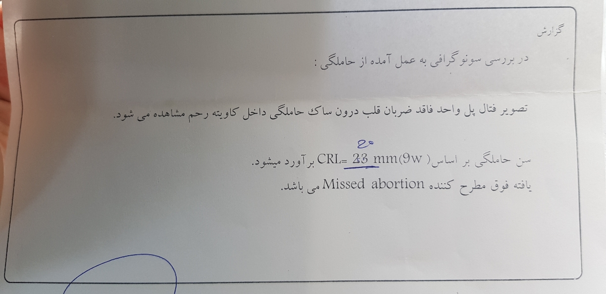 سقط جنین تو ۸هفته و ۴روز سقط جنین تو ۸هفته و ۴روز