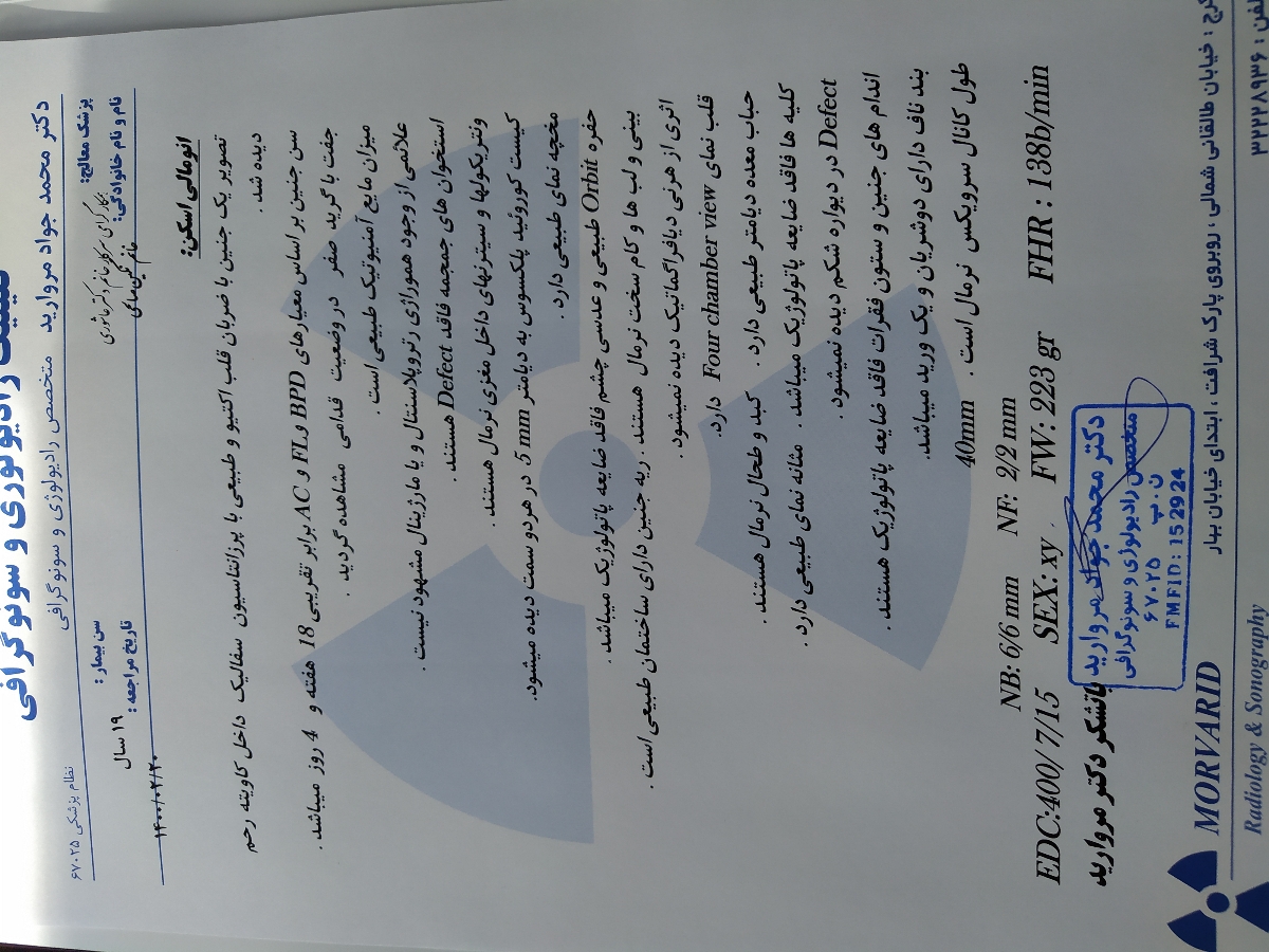 فشار به واژن و تکرر ادرار فشار به واژن و تکرر ادرار