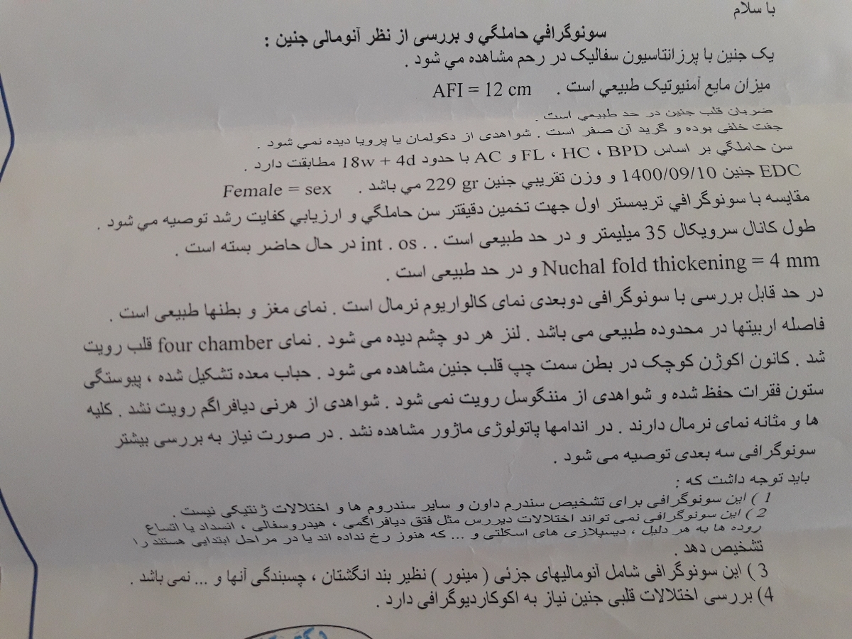 سلام به همگی لطفا سنو انومالی منو نگاه کنین سلام به همگی لطفا سنو انومالی منو نگاه کنین