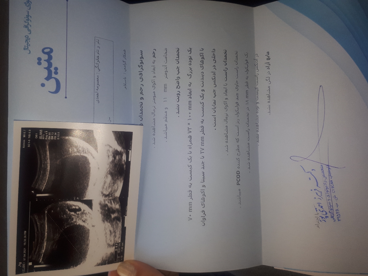 تفسیر سونوگرافی رحم تخمدان ها