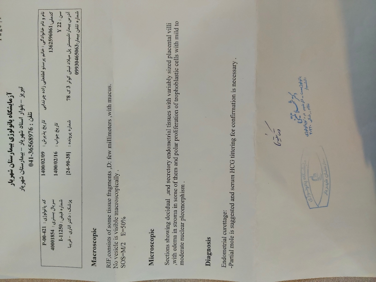 بعد از کورتاژ تا چن وقط نباید باردارشد بعد از کورتاژ تا چن وقط نباید باردارشد