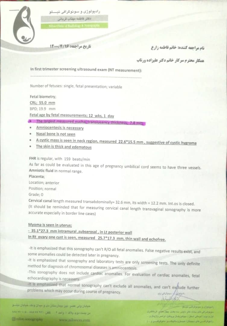 عدد nt بالا در غربالگری اول عدد nt بالا در غربالگری اول