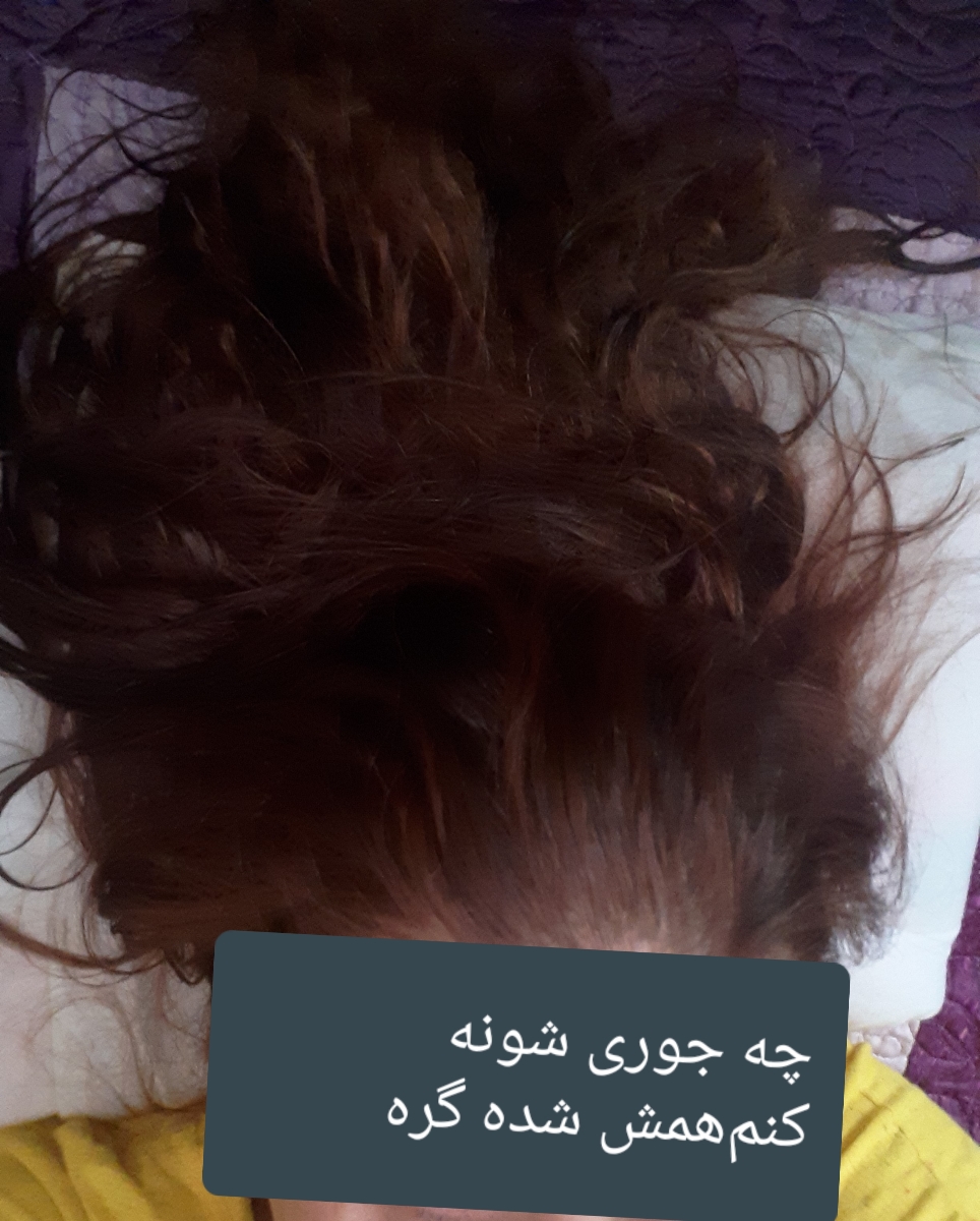 موهام دارنمیریرن همشون بعد شونه نمیشه موهام دارنمیریرن همشون بعد شونه نمیشه