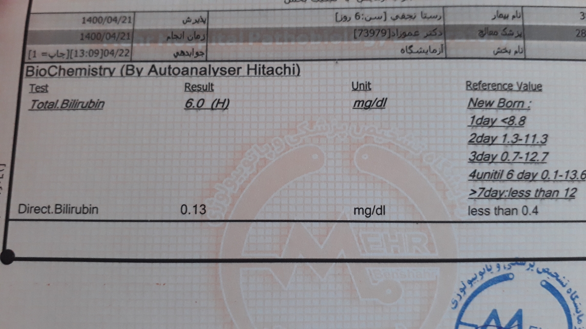 تفسیر جواب ازمایش زردی نوزاد