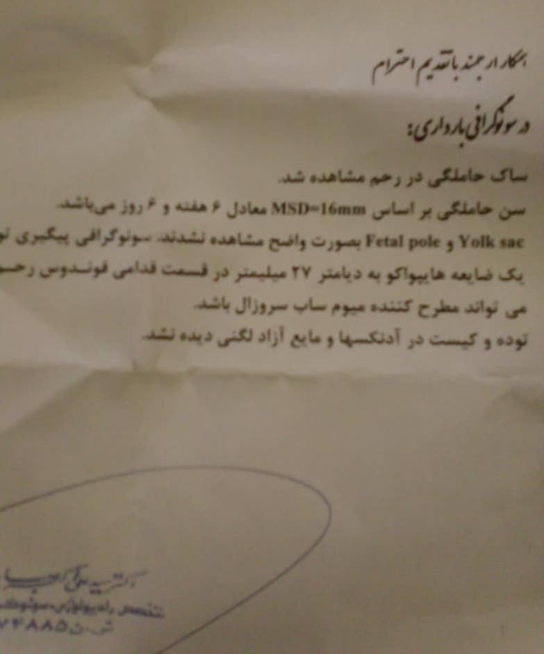 تفسیرسونوگرافی تشکیل قلب