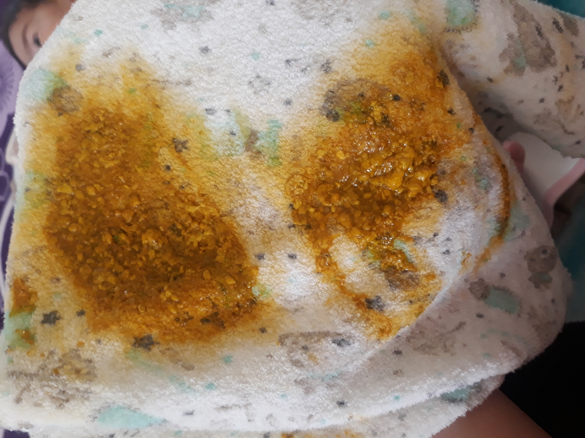 درباره سرما خورذگی نوزاد