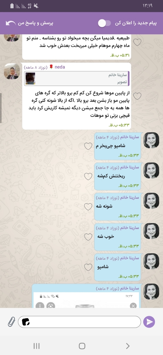 ریزش مو شدید در شیر دهی ...