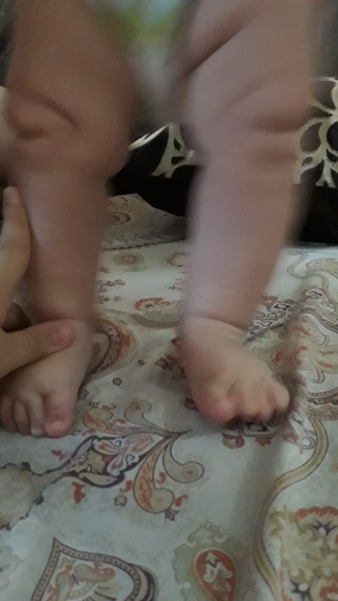 پرانتزی بنظر رسیدن پای نوزاد😣😥 پرانتزی بنظر رسیدن پای نوزاد😣😥