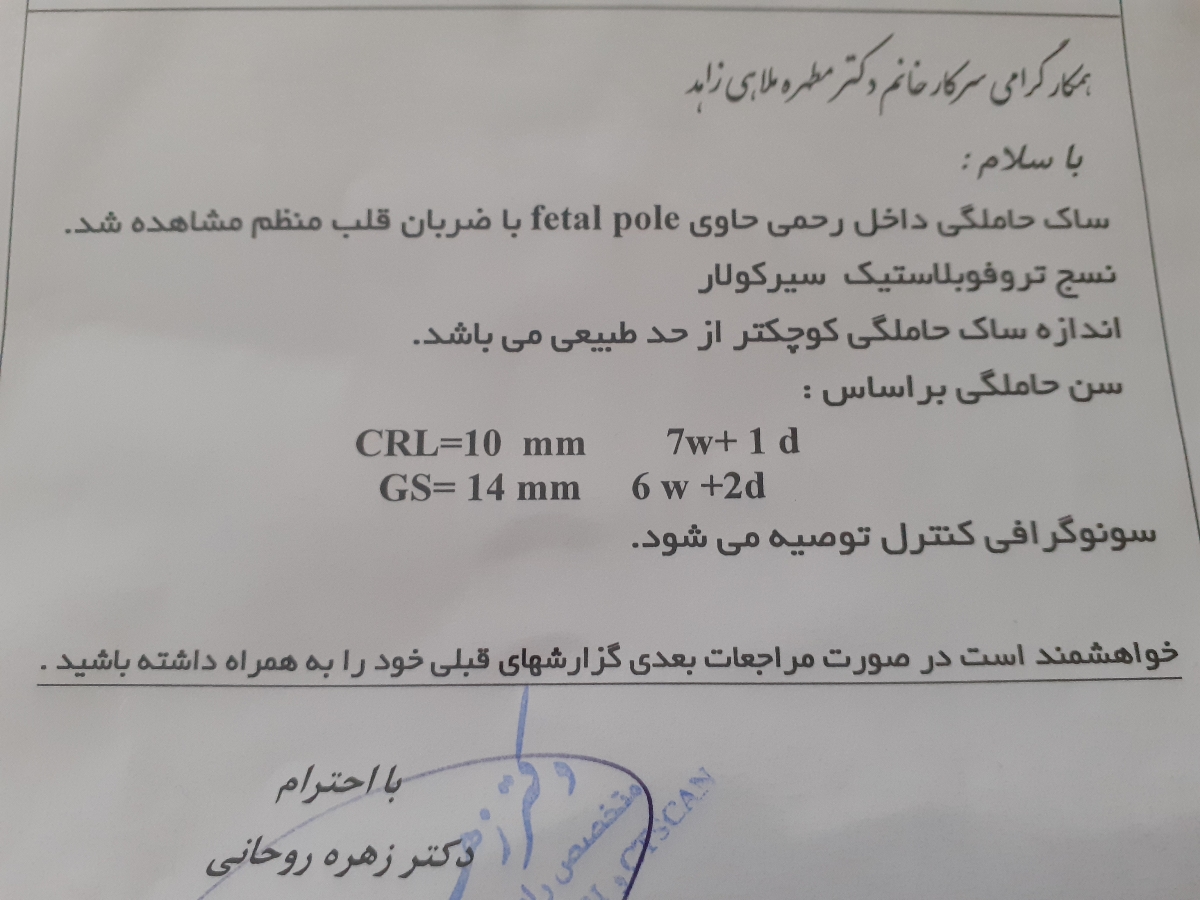 کوچیک بودن ساک حاملگی