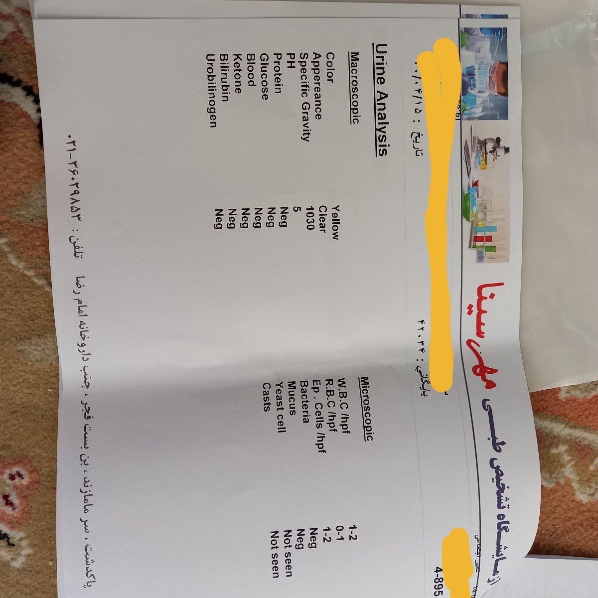 مایع آزاد در لگن در بارداری