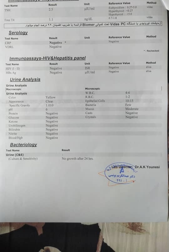 تفسیر آزمایش کی بلده