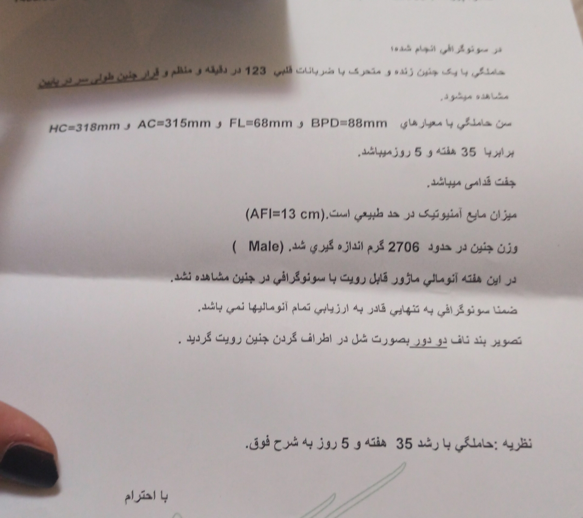 پیچیدن بند ناف دخترا زودبیایین پیچیدن بند ناف دخترا زودبیایین