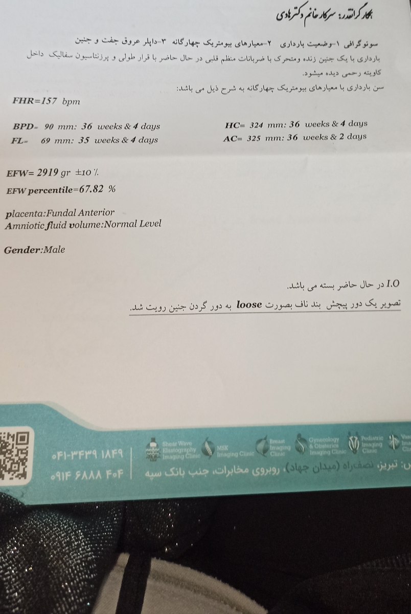 پیچیدن بند ناف دخترا زودبیایین پیچیدن بند ناف دخترا زودبیایین