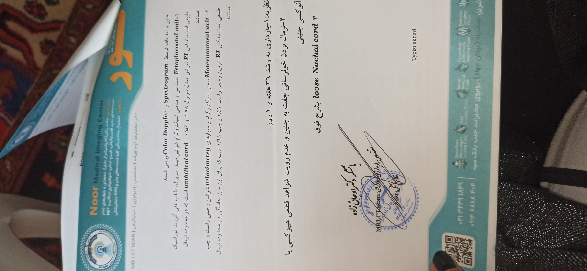 پیچیدن بند ناف دخترا زودبیایین پیچیدن بند ناف دخترا زودبیایین