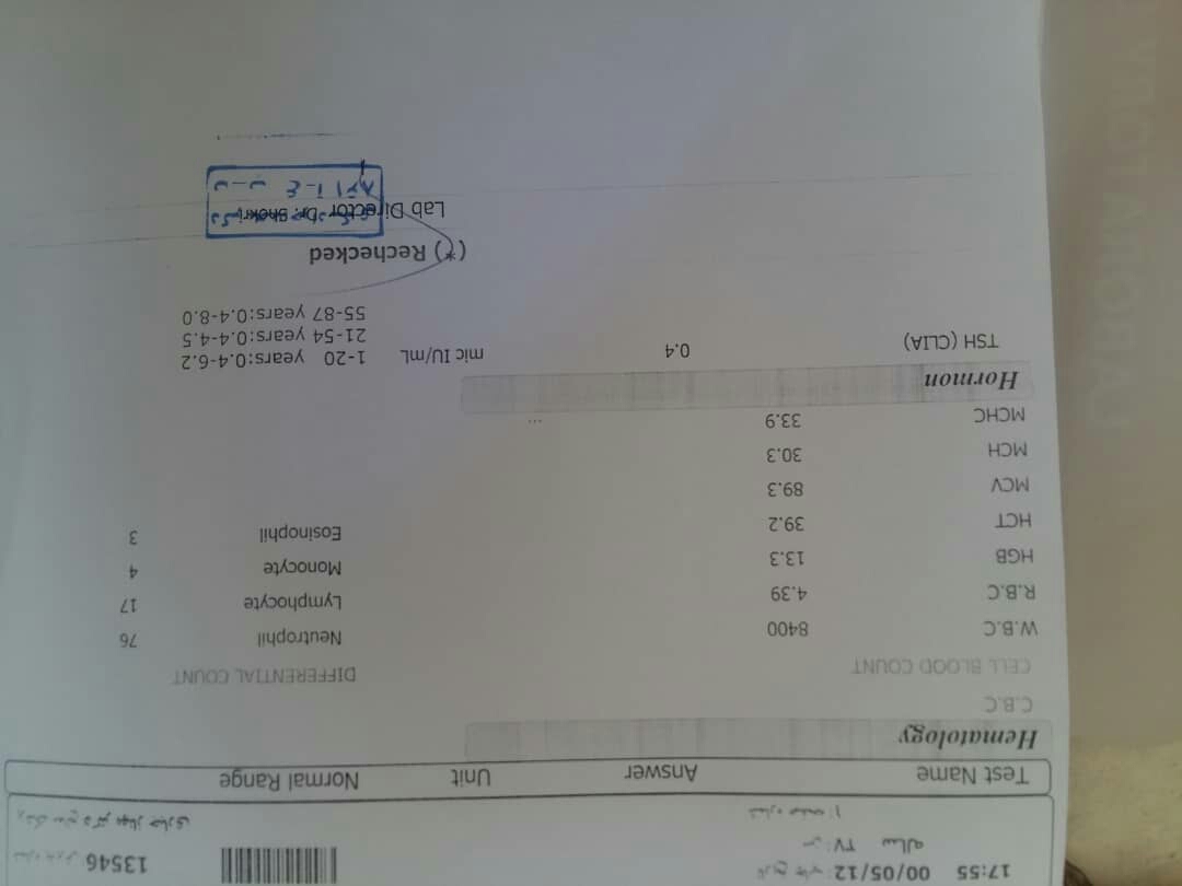 کم کاری تیروئید و غلظت خون