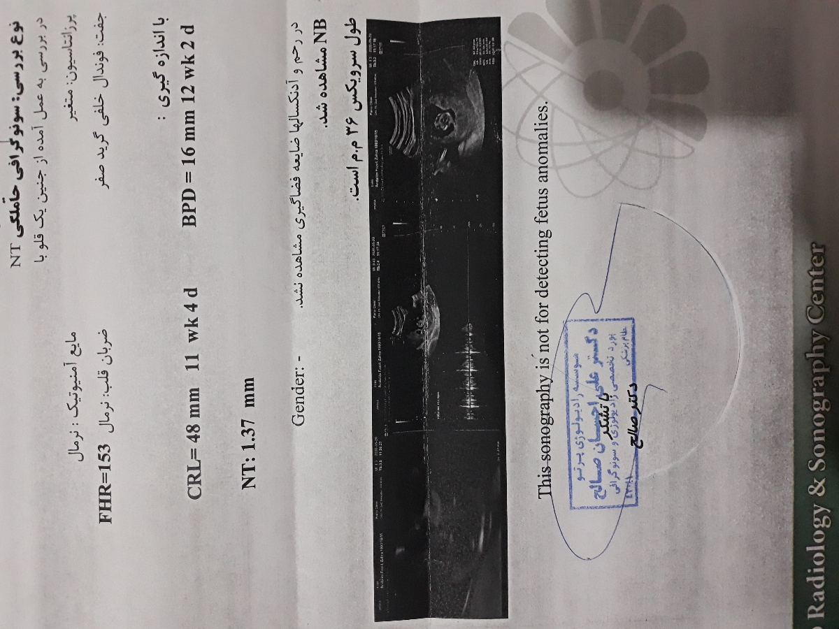 جواب ازمایش ان اتی NT جواب ازمایش ان اتی NT