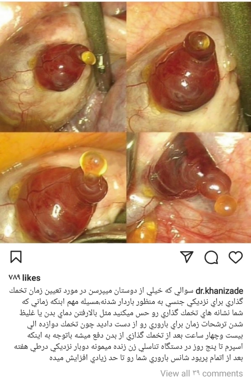 عکس آزاد شدن تخمک براتون فرستادم ببینین گوگولیارو؟😂