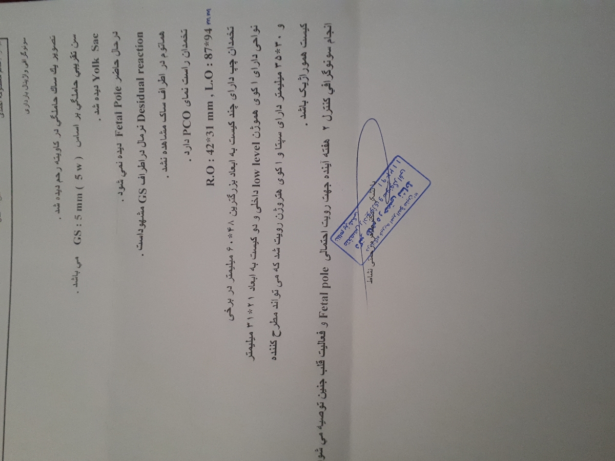 بارداری با کیست همرواژیک بارداری با کیست همرواژیک
