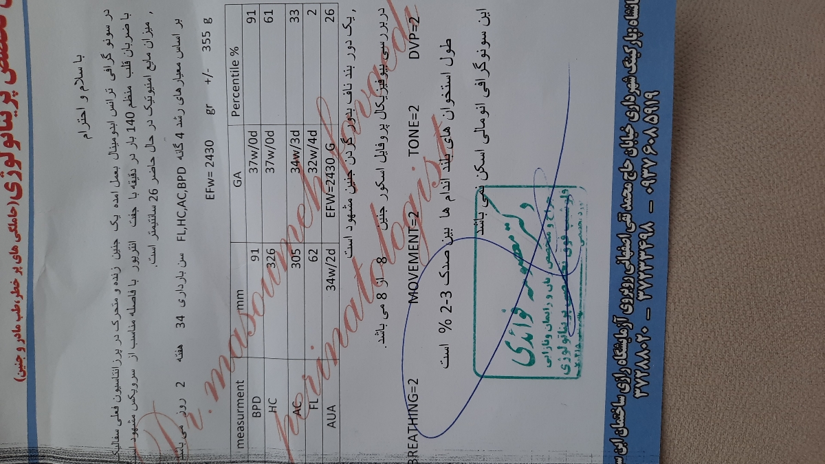 کیست آندومتریوز و بارداری