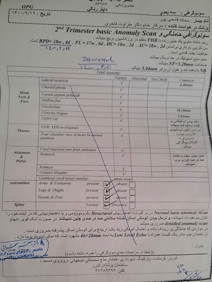 کیست آندومتریوز و بارداری