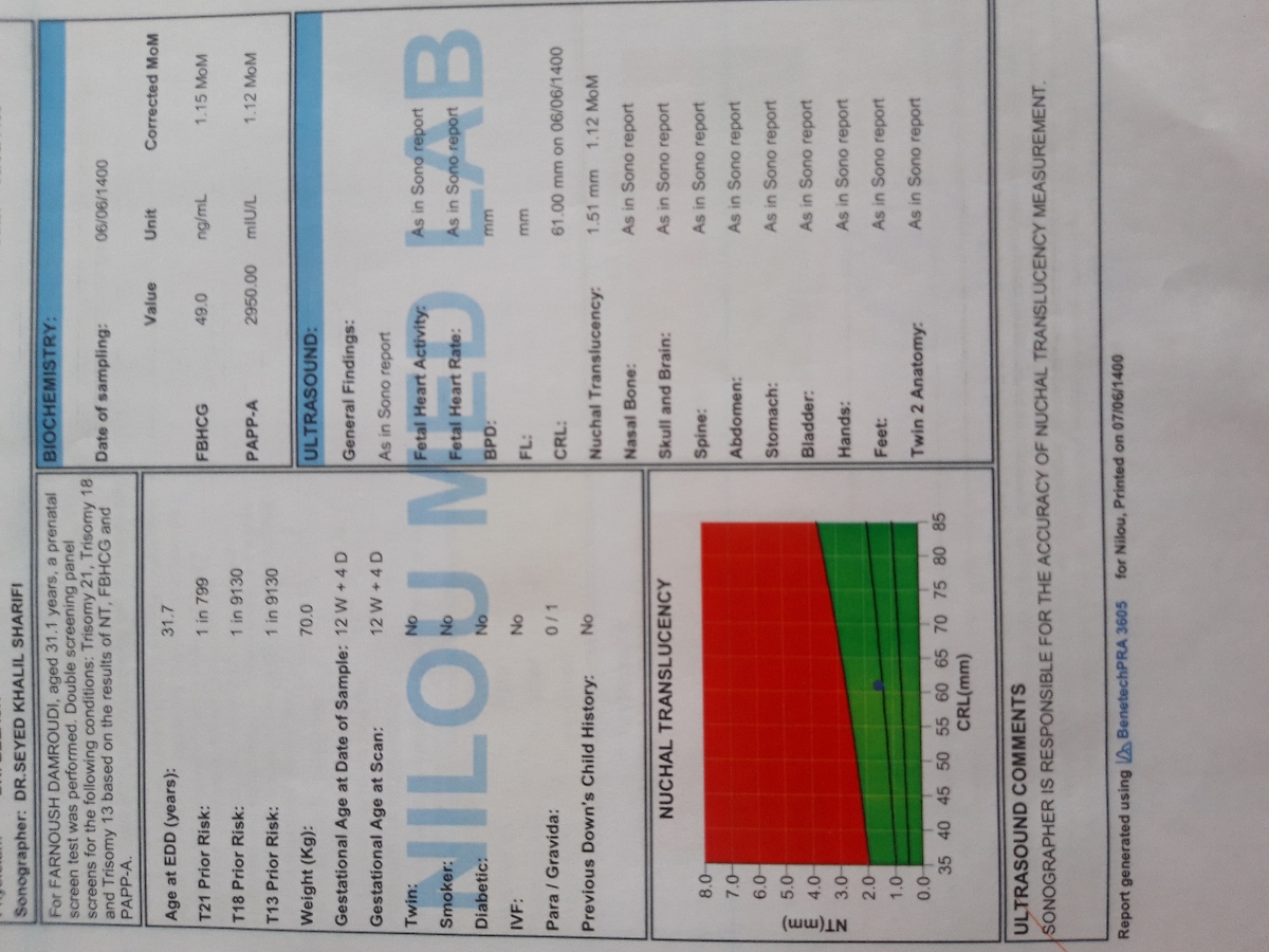 تفسیر سونوگرافی و ازمایش غربالگری اول ان تی تفسیر سونوگرافی و ازمایش غربالگری اول ان تی