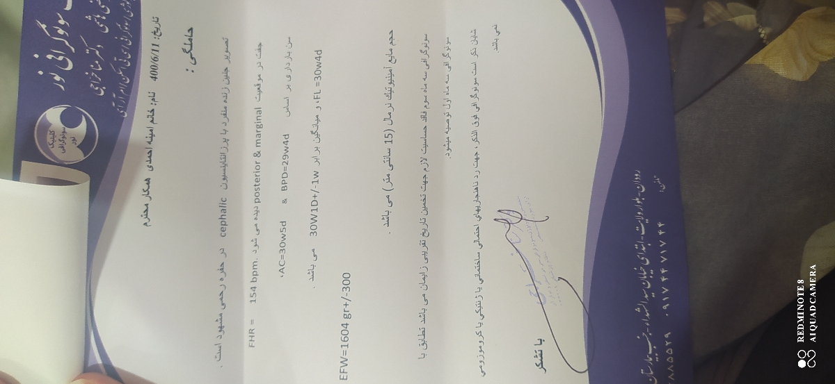 تفسیر سونو وزن بچه؟