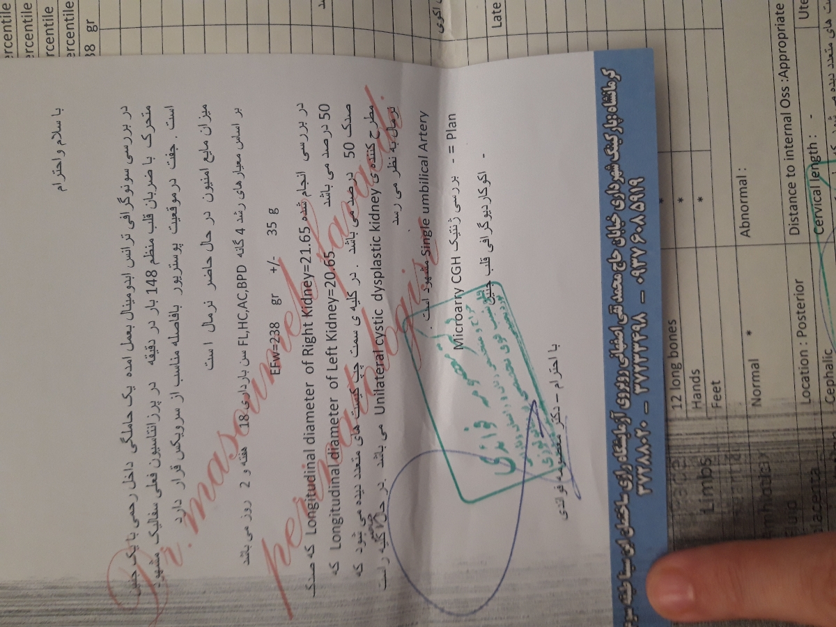 کلیه جنین پلی کیستیک