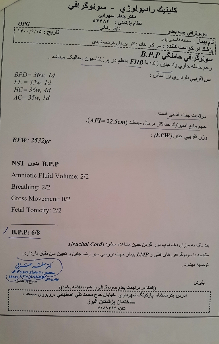 سونوگرافی جنین ۳۵ هفته سونوگرافی جنین ۳۵ هفته