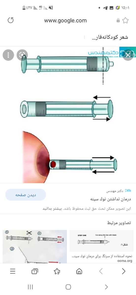 شیردهی با نوک سینه کوچک وفرورفته شیردهی با نوک سینه کوچک وفرورفته