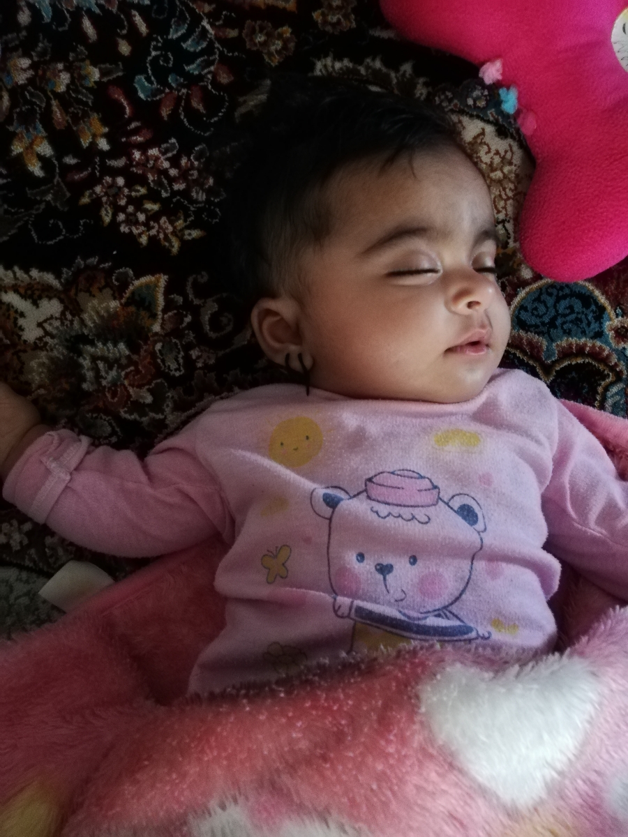 کجی گردن و سر نوزاد دوماه و نیم کجی گردن و سر نوزاد دوماه و نیم