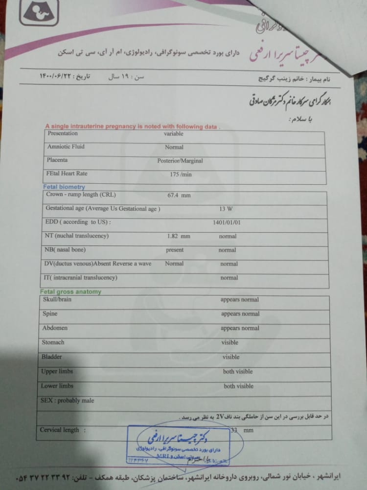 تفسیر سونو ان تی و بند ناف 2V تفسیر سونو ان تی و بند ناف 2V