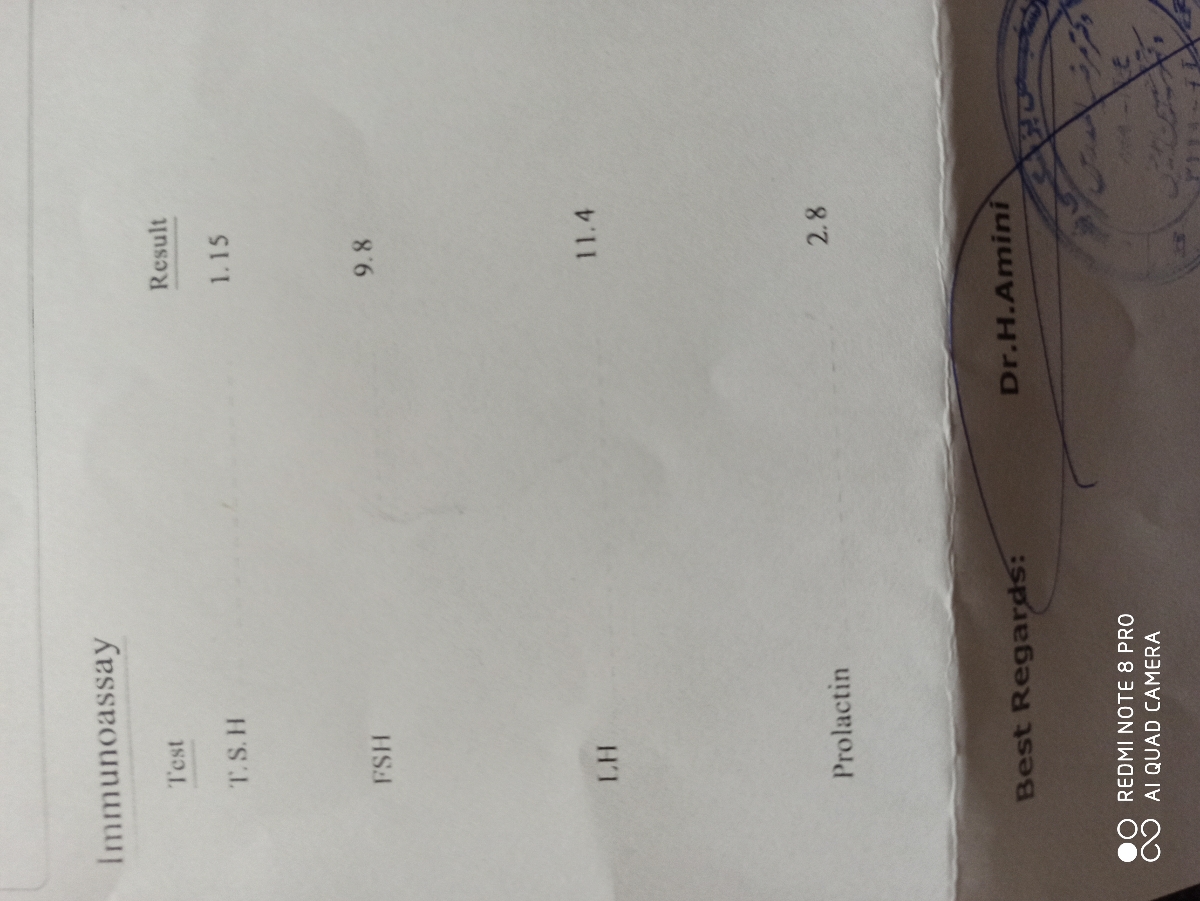 سونو و ازمایش برای تنبلی تخمدان