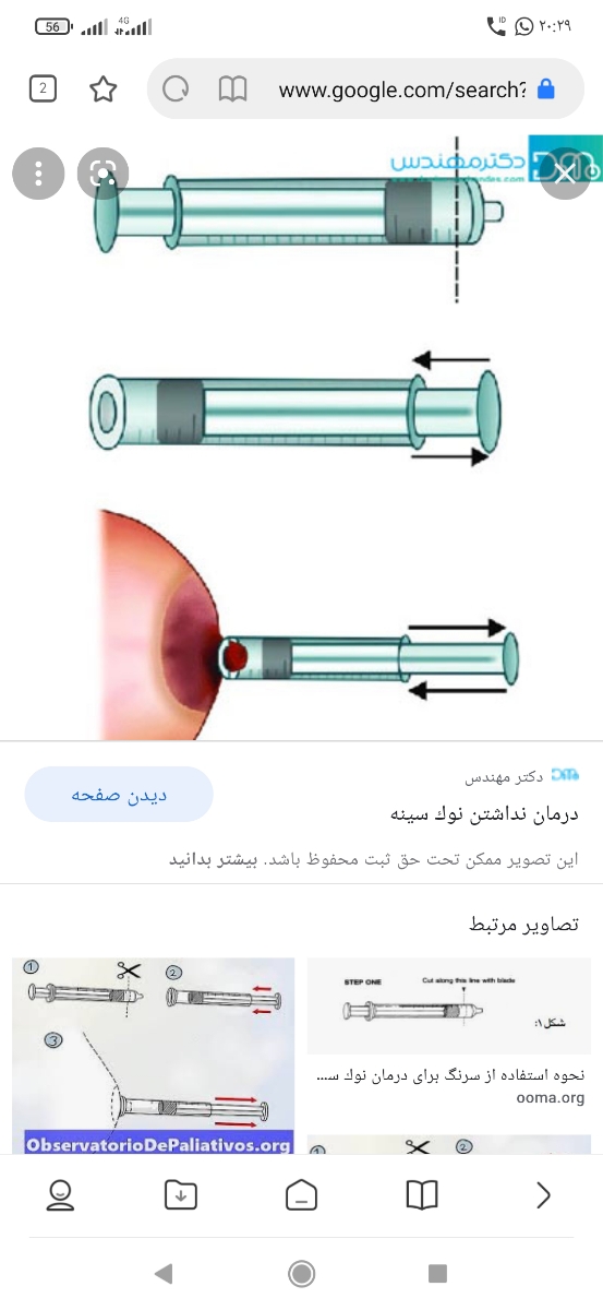 چکار کنیم سره سینه بیرون بیاد نوزاد بتونه شیر بخوره چکار کنیم سره سینه بیرون بیاد نوزاد بتونه شیر بخوره