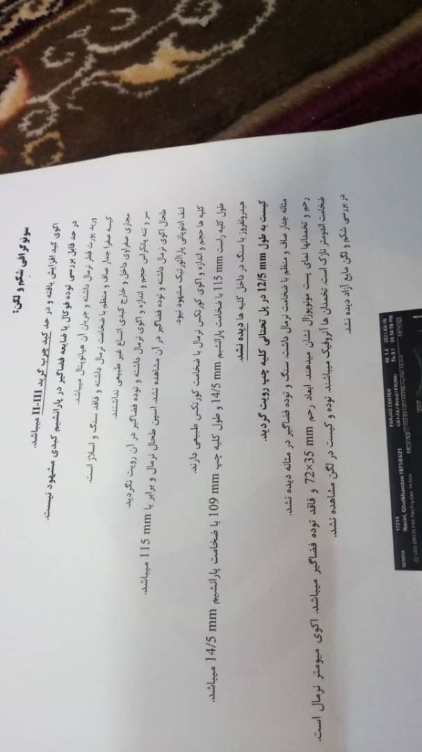 سونوگرافی تخمدان و رحم مادرم