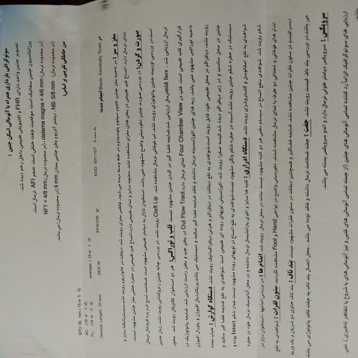 دوستان سونو آنومالی منو بگید دوستان سونو آنومالی منو بگید