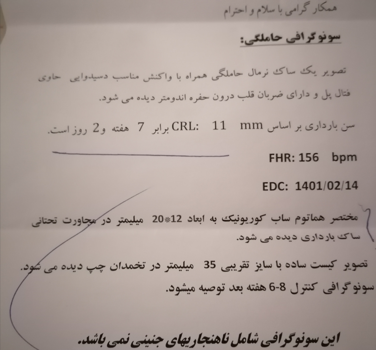 کیست ساده تخمدان چپ کیست ساده تخمدان چپ