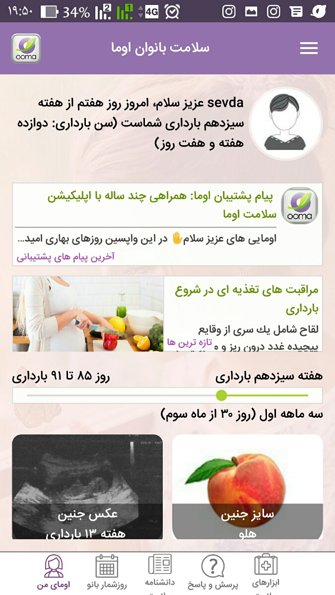 وارد کردن تاریخ سونو ان تی در اوما وارد کردن تاریخ سونو ان تی در اوما