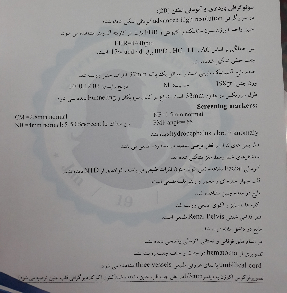 سونوگرافی انومالی و وجود رسوب در بطن چپ قلب جنین سونوگرافی انومالی و وجود رسوب در بطن چپ قلب جنین