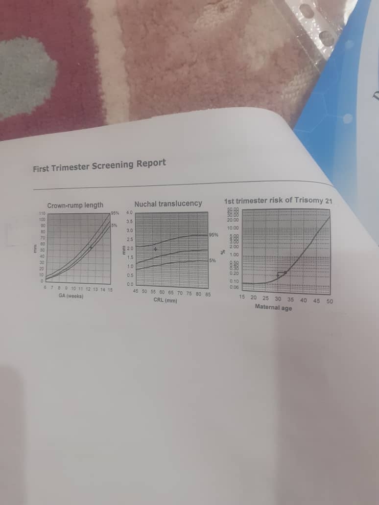 تفسیر سونو NT رو نگاه میکنید لطفا