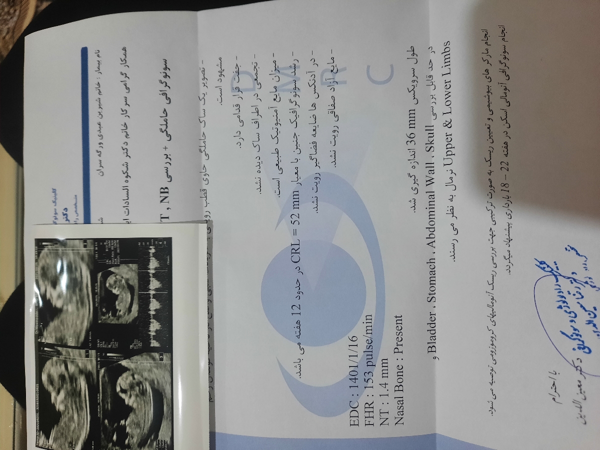 غربالگری سه ماه اول