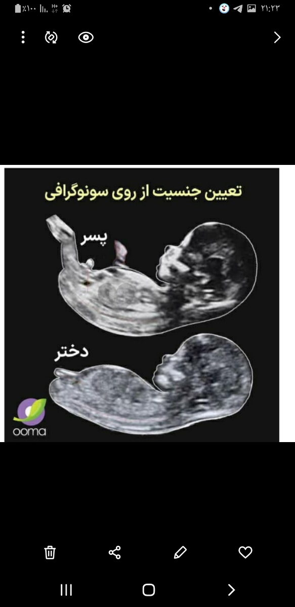 غربالگری سه ماه اول