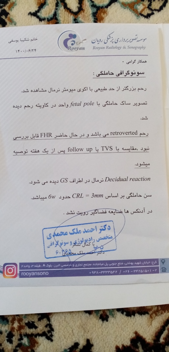 سنو 20 روز عقب افتادن پریودی